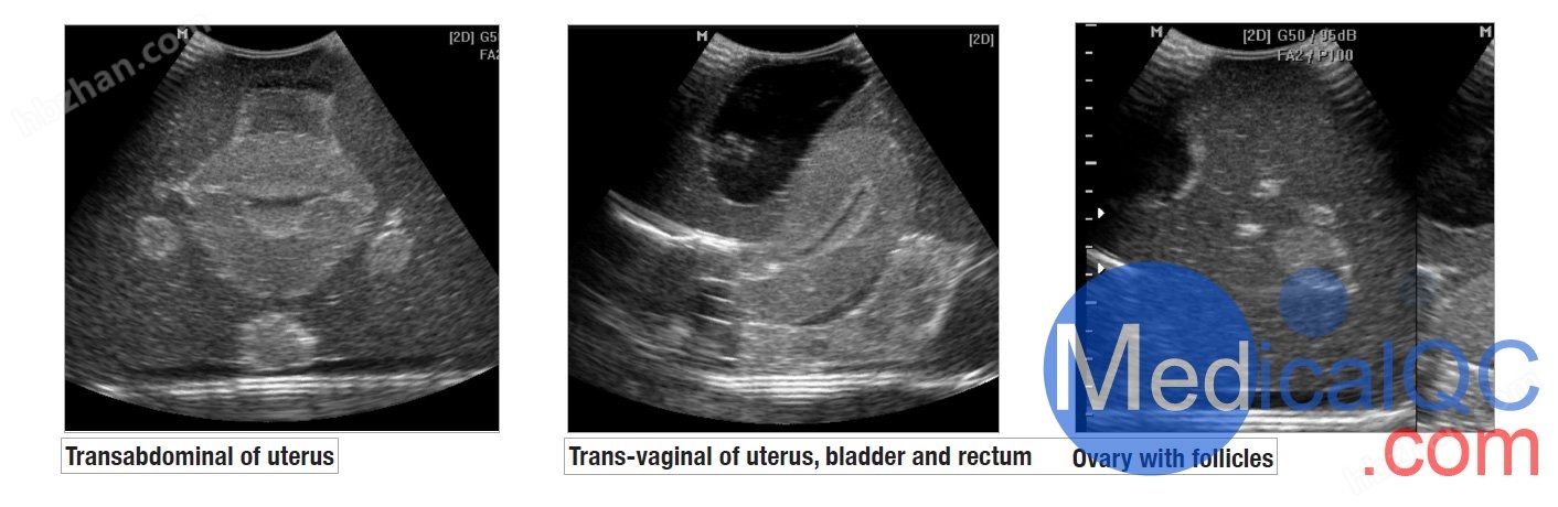 CIrs 404A超声训练骨盆模体